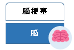 脳の血管が狭窄すると脳梗塞を引き起こします